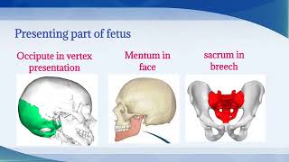 Malposition  Definition Etiology Diagnosis Management of malposition  Easy explanation OBGY Nsg [upl. by Eihcir]