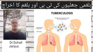 Tuberculosis Homeo treatment DrSohail Janjua [upl. by Palmore51]