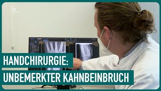 Kahnbeinpseudoarthrose  Experten für heile Hände  55  Die Gesundmacher [upl. by Assetal137]