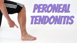 Peroneal Tendonitis Side of Foot Pain Causes amp SelfTreatment [upl. by Nefets]