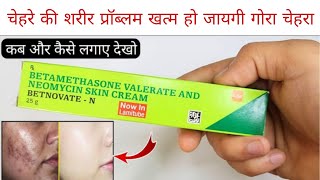 Betnovate N Cream  Betnovate n lagane sekya hota hai  फायदे और नुकसान  Review [upl. by Bing935]