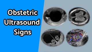 Obstetric Ultrasound Signs [upl. by Peatroy]