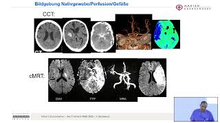 Neurologische Fortbildung NAIS 2022 [upl. by Anihsit960]