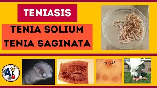 TENIASIS  Taenia solium y saginata [upl. by Sert]