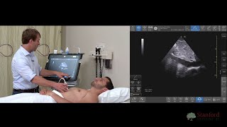 Examining the Inferior Vena Cava IVC with Point of Care Ultrasound POCUS [upl. by Keverne585]