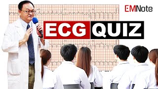 ECG Quiz for ACLS and Clinical Practice [upl. by Melicent]