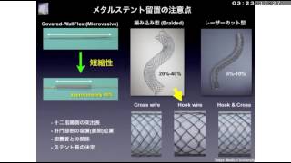 ステント治療の紹介 [upl. by Kermie]