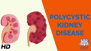 Polycystic kidney Disease Causes Signs and Symptoms Diagnosis and Treatment [upl. by Urbannai]