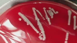 Microbiology Normal flora versus Pathogens [upl. by Nikolas]