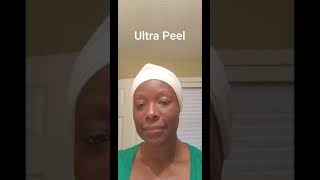 PCA  ULTRA PEEL [upl. by Ferren]