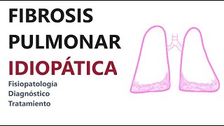 Neumología  Fibrosis pulmonar idiopática fisiopatología diagnóstico y tratamiento [upl. by Constanta]