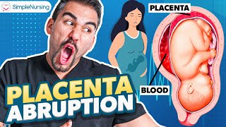 Placental Abruption Symptoms Causes Nursing Interventions  NCLEX Tips [upl. by Godliman]