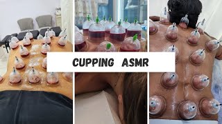 Cupping therapy Asmr amp body relaxation [upl. by Parrish]