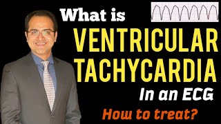 Ventricular Tachycardia VT ECG Interpretation Treatment ACLS Management Lectures USMLE NCLEX [upl. by Veronica]