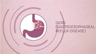 Gastrointestinal Problems amp Symptoms  Digestive System Diseases  Fortis Bangalore [upl. by Notreb]