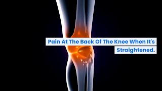 Knee Pain When Straightening Causes Symptoms and Home Remedies Explained  BuoyHealthcom [upl. by Lika]