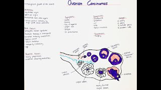 Ovarian Carcinomas  Histology Types Symptoms Diagnosis Risk Factors Treatment Prognosis [upl. by Elleraj941]