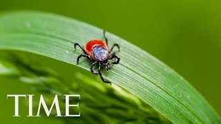 Powassan Virus Is the Scary New Reason to Avoid Ticks  TIME [upl. by Groark228]