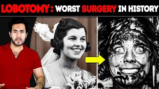 Why is LOBOTOMY The WORST Surgery in History [upl. by Lotz]