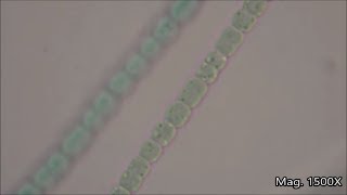 Anabaena under the Microscope [upl. by Luanni]