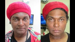 Visual Sculpt™  Dr Destangs Signature 30 Minute Facelift [upl. by Dian]