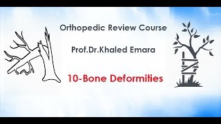 10Bone Deformities  profdrkhaled emara  اصلاح تشوهات العظام  أد خالد عمارة [upl. by Effy]