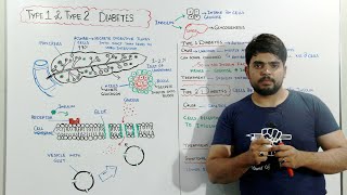 Diabetes mellitus type 1 and Type 2 [upl. by Najib]