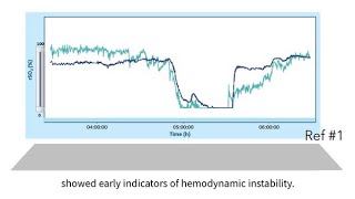 INVOS™ oximetry in the NICU Byte 11 NIRS as a guide to manage hemodynamic instability and shock [upl. by Laenaj]