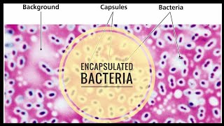 Encapsulated Bacteria [upl. by Mcleod]