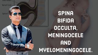 Spina Bifida occulta Meningocele and myelomeningocele [upl. by Pohsib281]