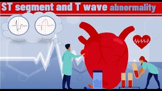 ST segment and T wave abnormality  ST T changes  classification and ECG examples  ECG basics [upl. by Annaehs795]