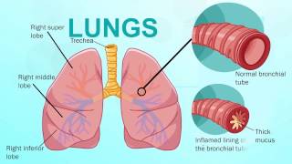 What Is Bronchitis [upl. by Bork709]