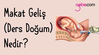 Makat Geliş Ters Doğum Nedir Makat Geliş Manevraları Nasıl Yapılır [upl. by Kitty]