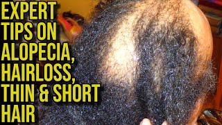 quotDefy Hair Loss Expert Tips for Alopecia Hair loss Short amp Thin Hair Challenges [upl. by Farlee]