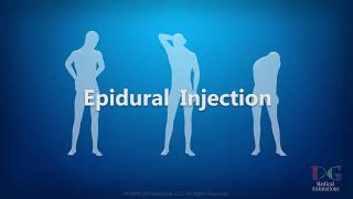 Epidural Injections for your Spine and Neck Patient Education [upl. by Jar]