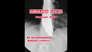 Final Years ESSAY Achalasia cardia [upl. by Hepzi]