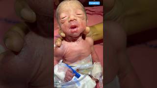 Newborn baby Video medical viralvideo [upl. by Aelat976]