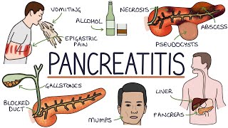 Understanding Pancreatitis [upl. by Fleming]