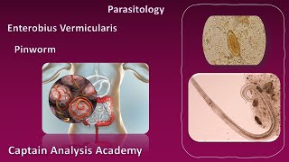 E4 parasitology Enterobius vermicularis الديدان الدبوسية [upl. by Lise]