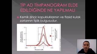 ODYOLOJİDE TİMPANOMETRİK TESTLER VE DEĞERLENDİRİLMELERİ [upl. by Lydnek]