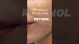 RetinolThe Ugly Truth you must know shorts retinol skincare retinal fyp beginnerfriendly [upl. by Arukas]