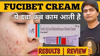 fucibet cream  fucibet cream uses in hindi  fucibet cream uses [upl. by Klatt836]