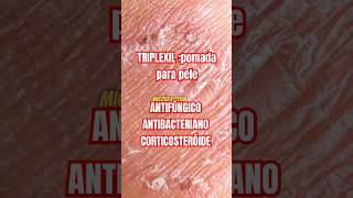 Triplexil clotrimazole batametasona gentamicina pomada cuidadoscomapele antifugico Saude [upl. by Siaht360]