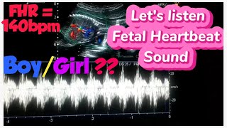 Baby heartbeat sound on ultrasound  heart rate boygirl  Fetal doppler heartbeat sound [upl. by Erait]