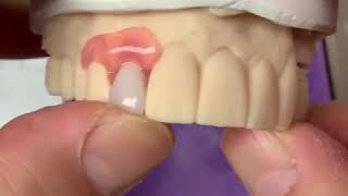 3D printed Mini Dentures [upl. by Eolande]