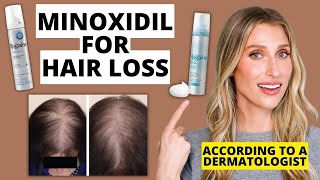 Dermatologist Explains How Minoxidil Works for Hair Loss How to Use Results amp More [upl. by Dutchman375]