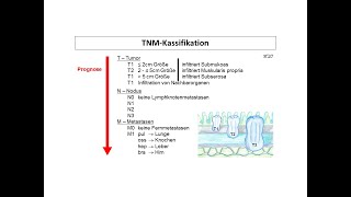 TNMKlassifikation Stadieneinteilung  Strahlentherapie Prof Hilke Vorwerk [upl. by Ilojne]