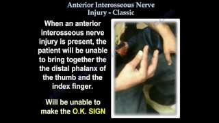 Anterior Interosseous Nerve Injury Classic  Everything You Need To Know  Dr Nabil Ebraheim [upl. by Adnohsar652]