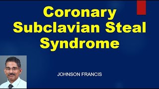 Coronary Subclavian Steal Syndrome [upl. by Notrab]