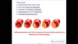 Higher Human Biology  Unit 2 7a Cardiovascular Disease [upl. by Weir]